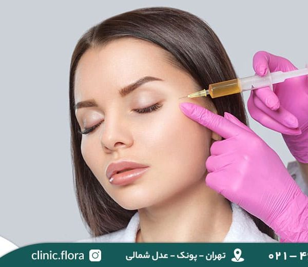 تزریق ژل